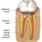 Penyakit gigi , mulut dan gusi , pencegahannya , ciri ciri gejalanya, dan pengobatanya